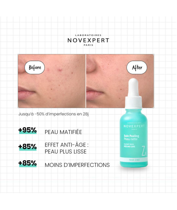 NOVEXPERT SOIN PEELING PEAU NETTE 30ML