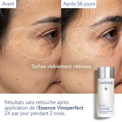 Caudalie Vinoperfect Essence Glycolique Concentrée d’Éclat 100ml